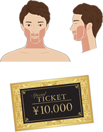 ヒゲ3部位セレクトプラン