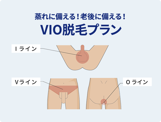 蒸れに備える！⽼後に備える！　VIO脱⽑プラン