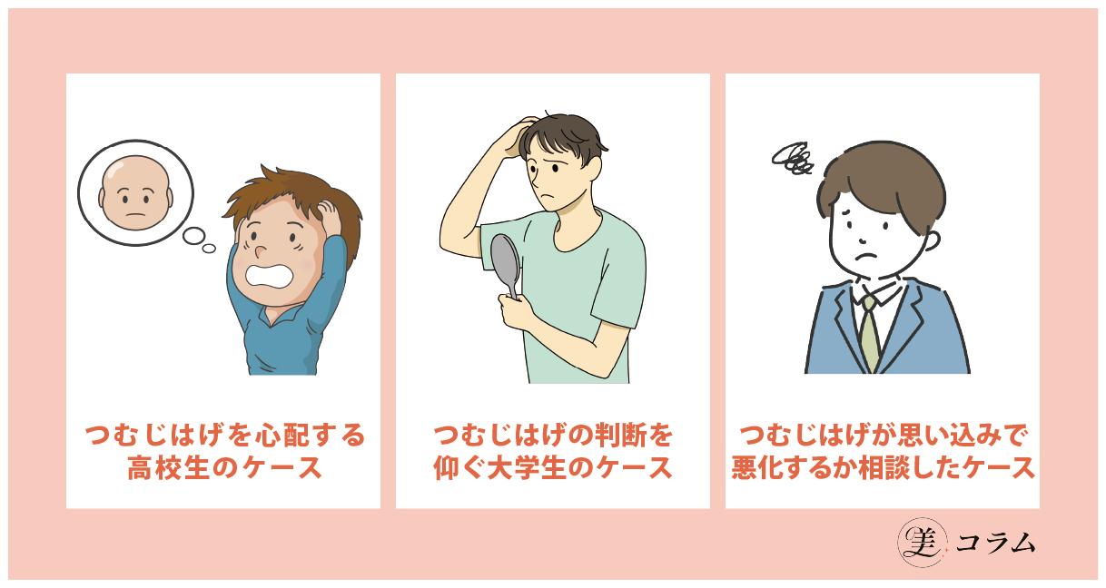 つむじはげの思い込みに関する男性の相談事例