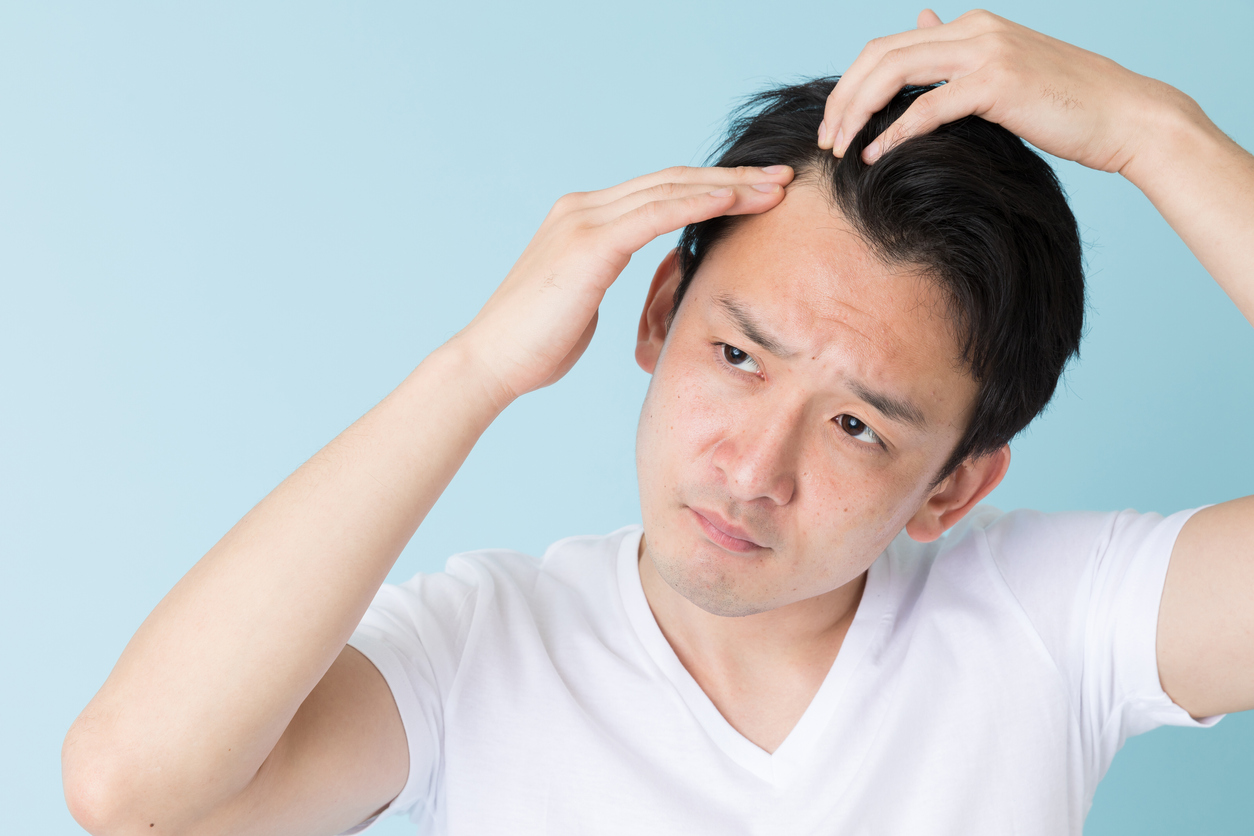 高校生もM字はげになる？見分け方のポイントを解説