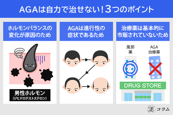 AGAを自力で治すのは不可能！3つの理由を解説