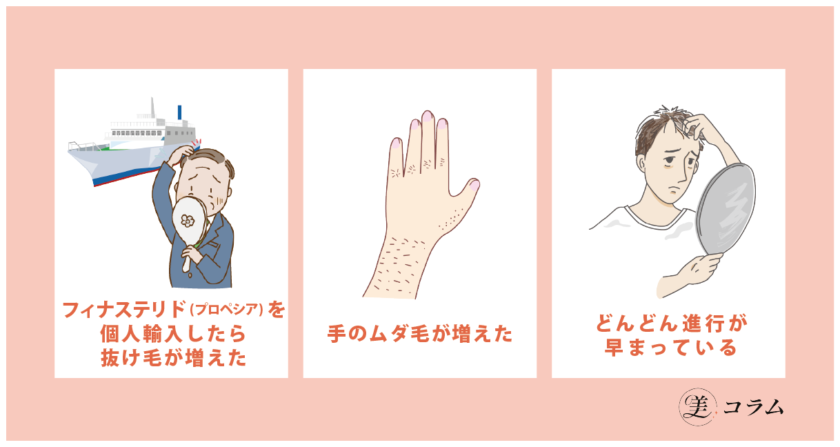 AGA治療薬を個人輸入した人のその後
