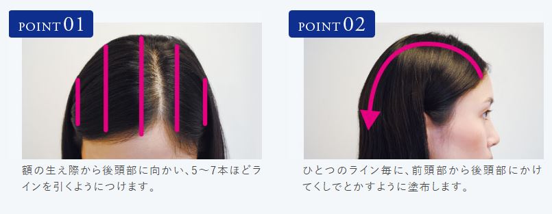 頭皮に直接薬剤を塗布